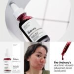 The Ordinary AHA 30% & BHA 2% Peeling Solution For Brighter Skin 30ml - Image 4