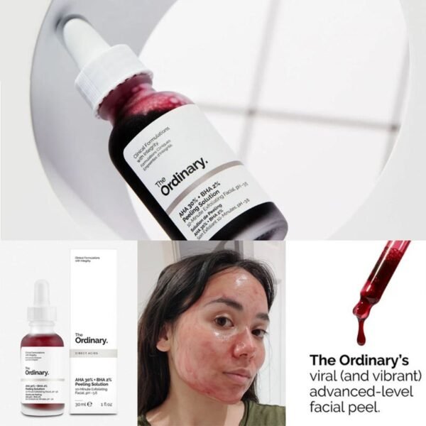 The Ordinary AHA 30% & BHA 2% Peeling Solution For Brighter Skin 30ml - Image 4