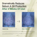 Anua Heartleaf Pore Control Cleansing Oil, Oil Cleanser for Face, Makeup Blackhead Remover, Korean Skin Care 6.76 fl oz(200ml) - Image 6