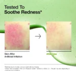 Anua Azelaic Acid 10 Hyaluron Redness Soothing Serum, Facial Serum for Sensitive skin, Hyaluronic Acid, Niacinamide, Spot Care, Natural Color, Vegan, Korean Skincare (30ml/ 1.01 fl oz.) - Image 4