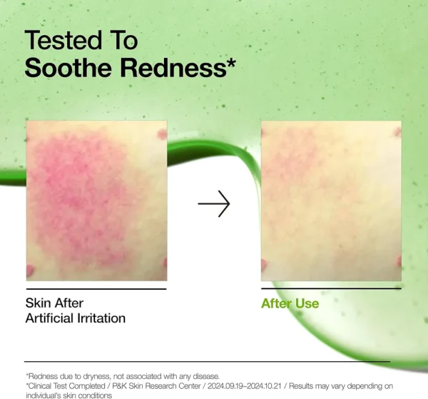Anua Azelaic Acid 10 Hyaluron Redness Soothing Serum, Facial Serum for Sensitive skin, Hyaluronic Acid, Niacinamide, Spot Care, Natural Color, Vegan, Korean Skincare (30ml/ 1.01 fl oz.) - Image 4